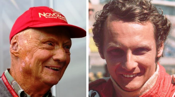 Niki Lauda è morto, aveva 70 anni. Formula 1 in lutto Niki Lauda è morto, aveva 70 anni. Formula 1 in lutto